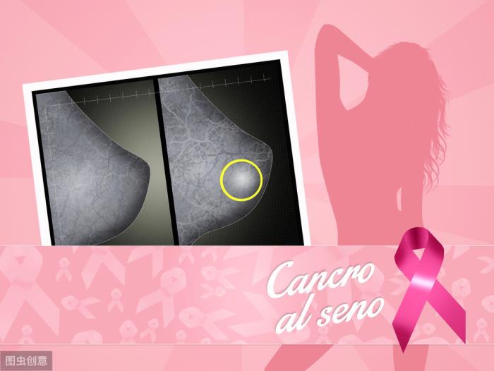 乳腺癌酒窝症状图片图片