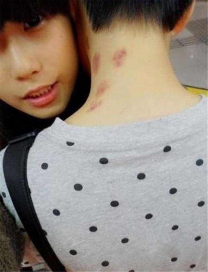 女生脖子上的草莓图片图片