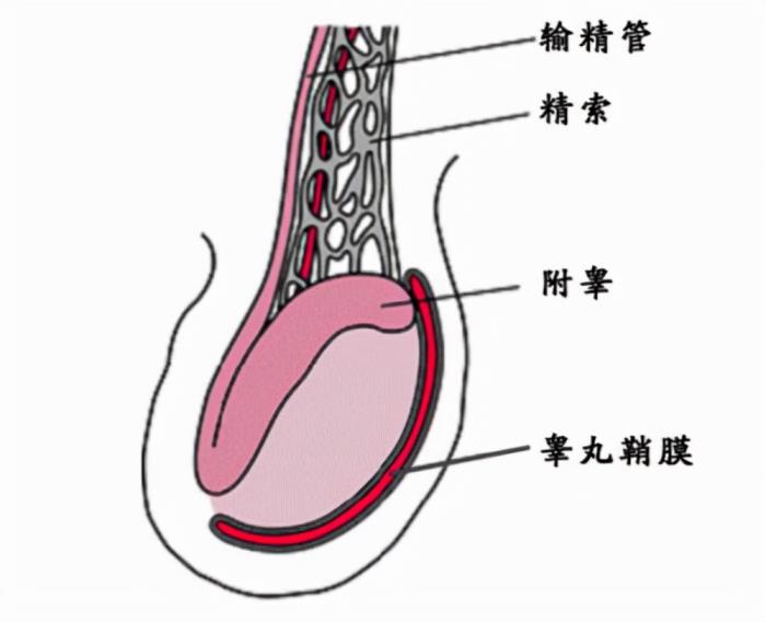 出现睾丸肿胀,质地坚硬和表面不平等症状,睾丸肿瘤通常发生在附睾尾部